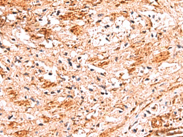 NADK Polyclonal Antibody (E-AB-19043)