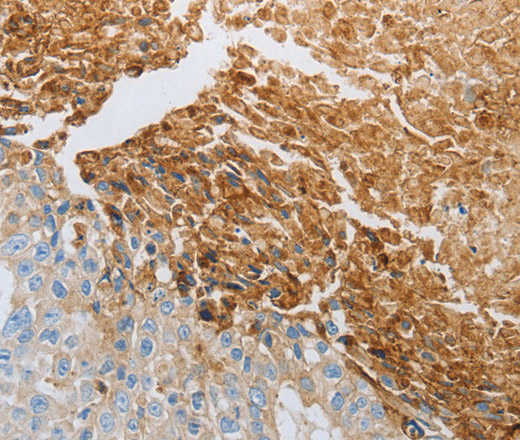 RTN4 Polyclonal Antibody (E-AB-12814)
