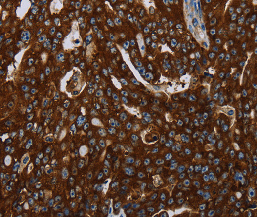 KISS1R Polyclonal Antibody (E-AB-13366)