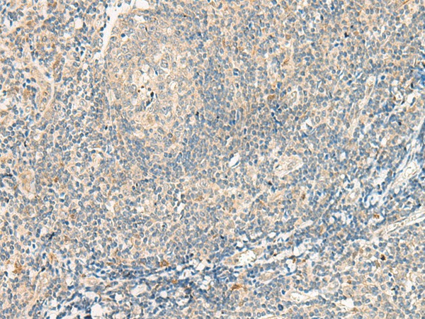 GPR75 Polyclonal Antibody (E-AB-19946)