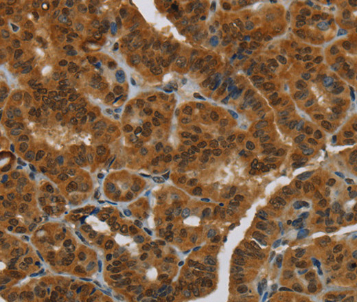 MRE11 Polyclonal Antibody (E-AB-15211)