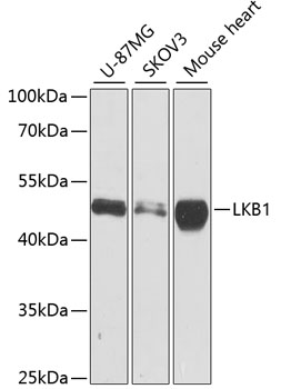 LKB1 Polyclonal Antibody (E-AB-60622)