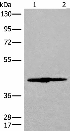 IVD Polyclonal Antibody (E-AB-18718)