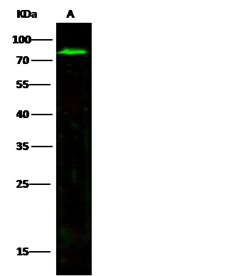 Recombinant MMP-2 Monoclonal Antibody (AN300112P)