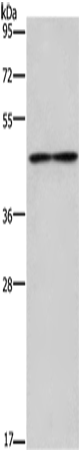IL5RA Polyclonal Antibody (E-AB-13329)