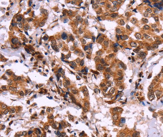 CARD11 Polyclonal Antibody (E-AB-11031)