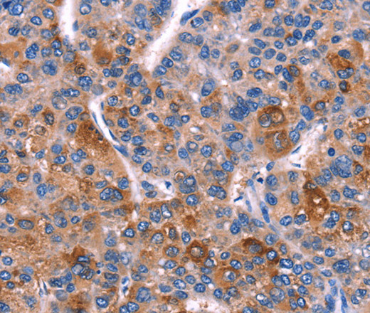 DUSP13 Polyclonal Antibody (E-AB-10306)