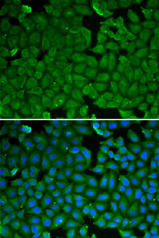 SPINK1 Polyclonal Antibody (E-AB-64705)