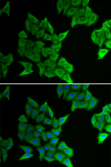 GJA5 Polyclonal Antibody (E-AB-64675)