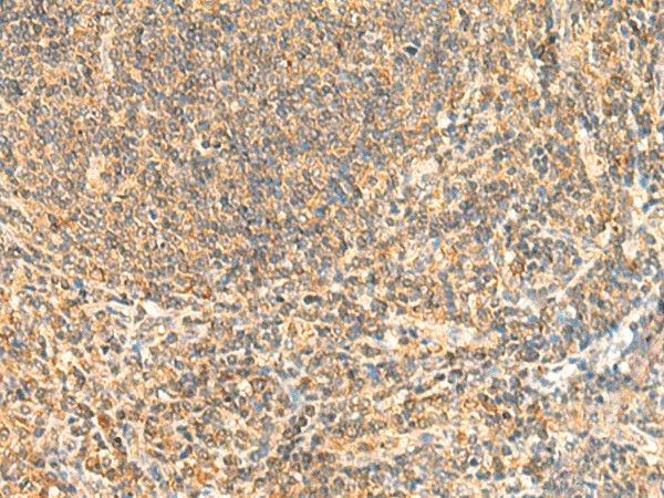 ZNF581 Polyclonal Antibody (E-AB-18932)