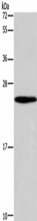 GUK1 Polyclonal Antibody (E-AB-16473)