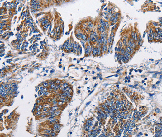 NPPA Polyclonal Antibody (E-AB-10956)