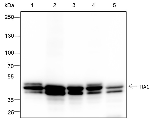 Recombinant TIA1 Monoclonal Antibody (AN301676L)