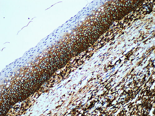 CD44 Monoclonal Antibody (ELAB6155-M)