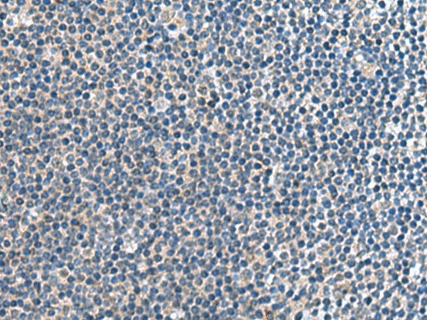 CNTN4 Polyclonal Antibody (E-AB-19092)