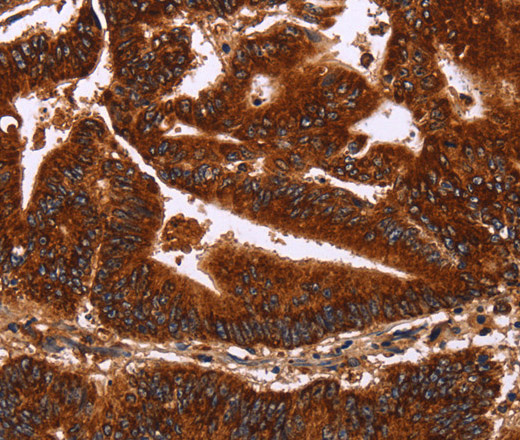 GCKR Polyclonal Antibody (E-AB-13267)