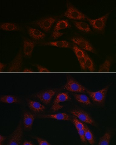 ABCA1 Polyclonal Antibody (E-AB-93395)