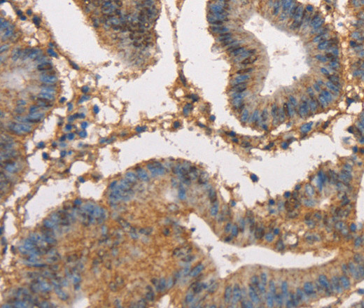 HK3 Polyclonal Antibody (E-AB-14705)