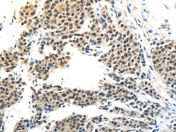 MAGEA6 Polyclonal Antibody (E-AB-17348)