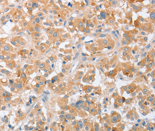 SIGLEC9 Polyclonal Antibody (E-AB-11057)