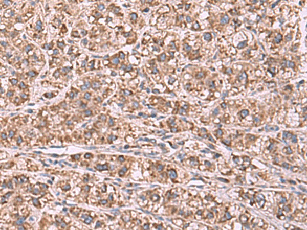 GUSB Polyclonal Antibody (E-AB-53000)