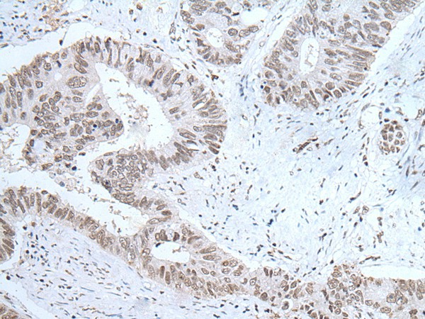 HCRT Polyclonal Antibody (E-AB-53517)
