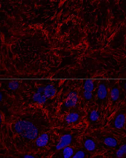 SEPT9 Polyclonal Antibody (E-AB-63893)