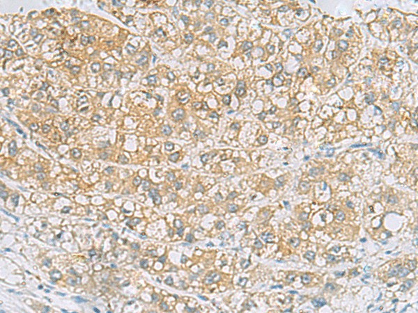 EPCAM Polyclonal Antibody (E-AB-19229)