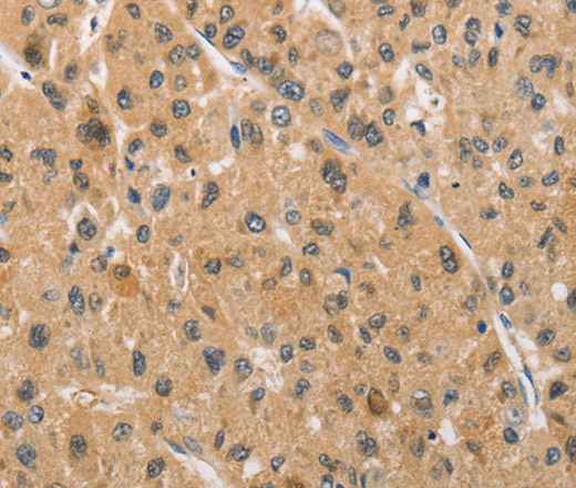 ARMCX1 Polyclonal Antibody (E-AB-14615)