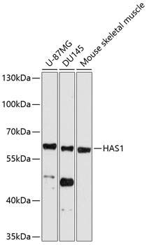 HAS1 Polyclonal Antibody (E-AB-90171)