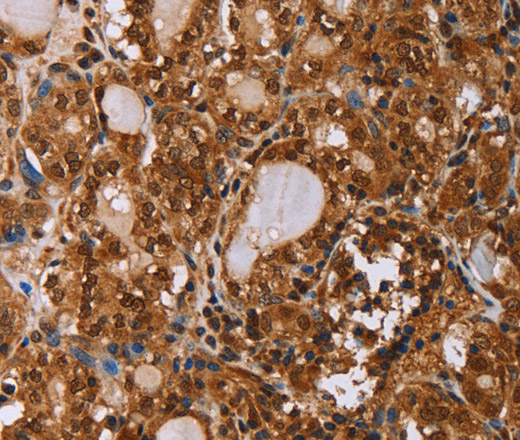 IHH Polyclonal Antibody (E-AB-15126)