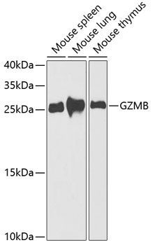 GZMB Polyclonal Antibody (E-AB-60730)