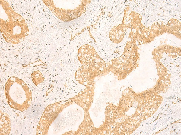 GSG1L Polyclonal Antibody (E-AB-18916)