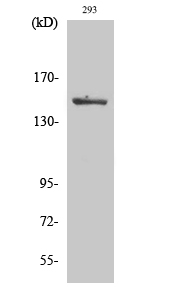 Phospho-MAP3K5 (Ser966) Polyclonal Antibody (E-AB-20813)