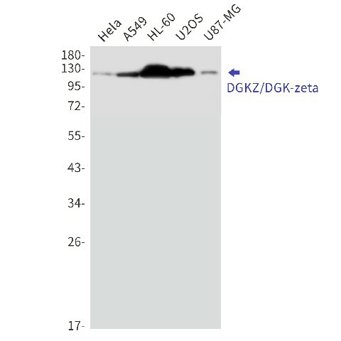 Recombinant DGKZ Monoclonal Antibody (E-AB-81502)