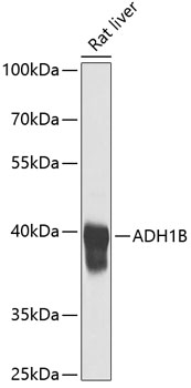 ADH1B Polyclonal Antibody (E-AB-62610)