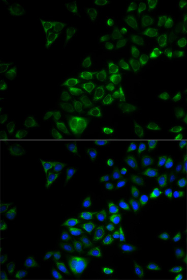 TRAF3 Polyclonal Antibody (E-AB-60836)