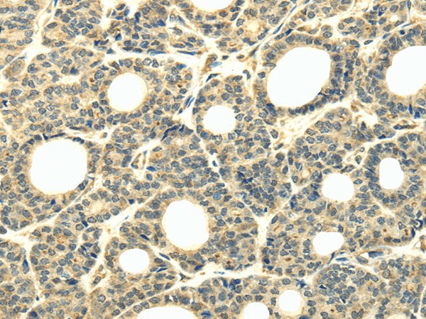 WDR45B Polyclonal Antibody (E-AB-17570)