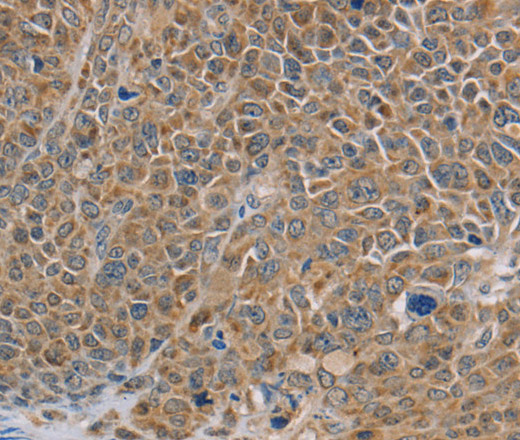NDUFS7 Polyclonal Antibody (E-AB-11433)