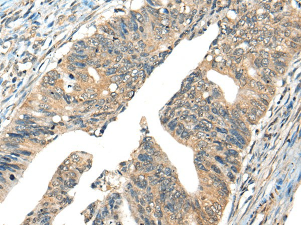 AIFM2 Polyclonal Antibody (E-AB-17820)
