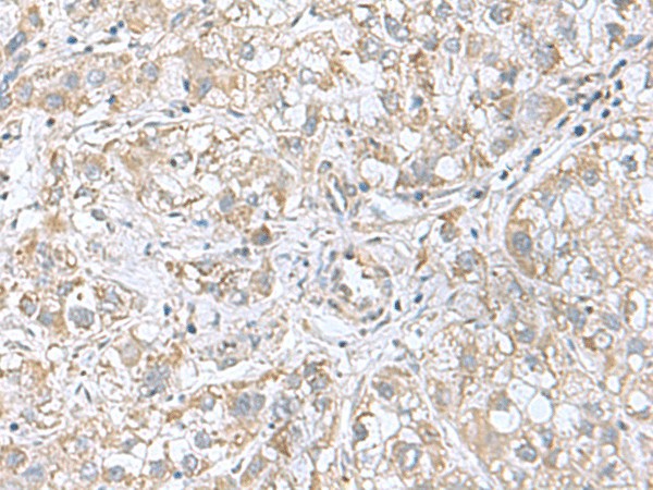 CGB5 Polyclonal Antibody (E-AB-19135)