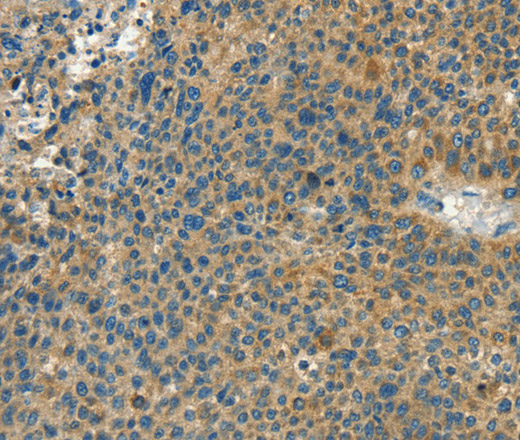 CALCA Polyclonal Antibody (E-AB-13027)