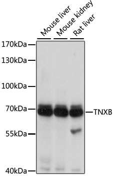 TNXB Polyclonal Antibody (E-AB-67471)
