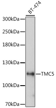 TMC5 Polyclonal Antibody (E-AB-66703)