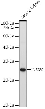 INSIG2 Polyclonal Antibody (E-AB-92163)