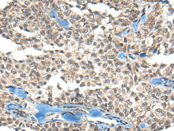 REST Polyclonal Antibody (E-AB-17813)