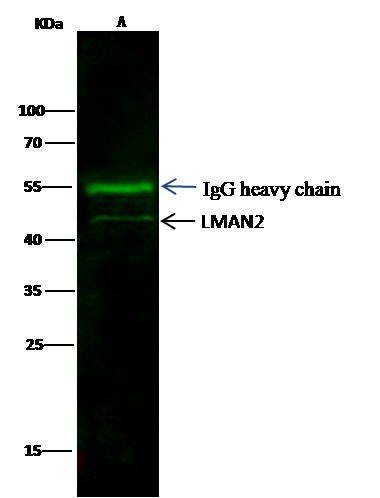 LMAN2/VIP36 Monoclonal Antibody (AN200132P)