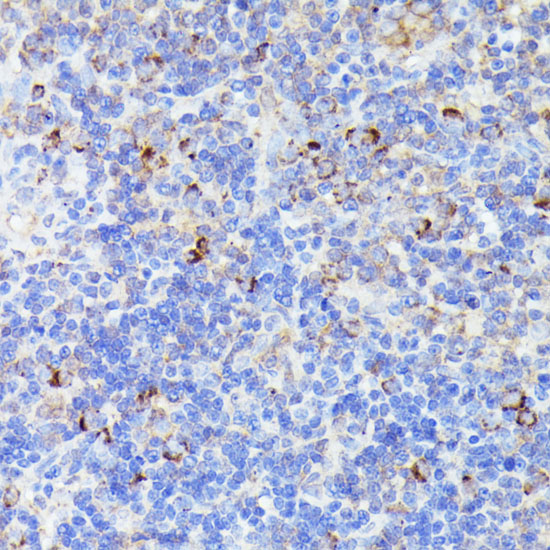 CCDC6 Polyclonal Antibody (E-AB-66679)