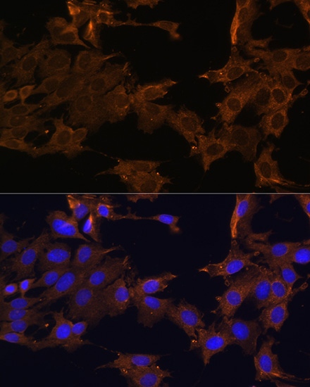PDGFR beta Polyclonal Antibody (E-AB-67422)