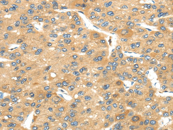 UBTD2 Polyclonal Antibody (E-AB-17506)